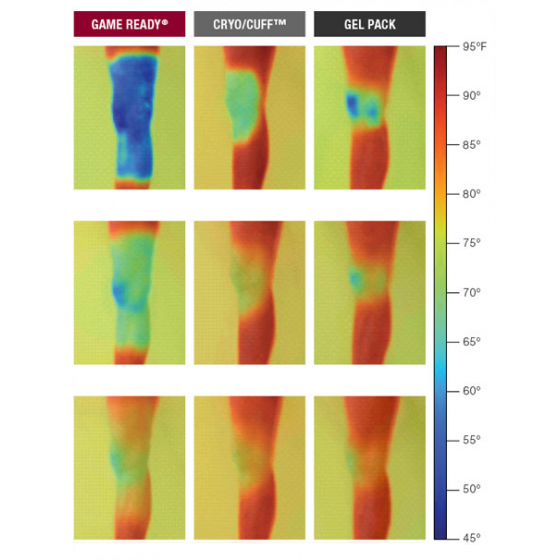 Thermographie Cryothérapie compressive Game Ready - Pack Professionnel - thermographie IR Thermographie Cryothérapie compressive Game Ready - Pack Professionnel - thermographie IR
